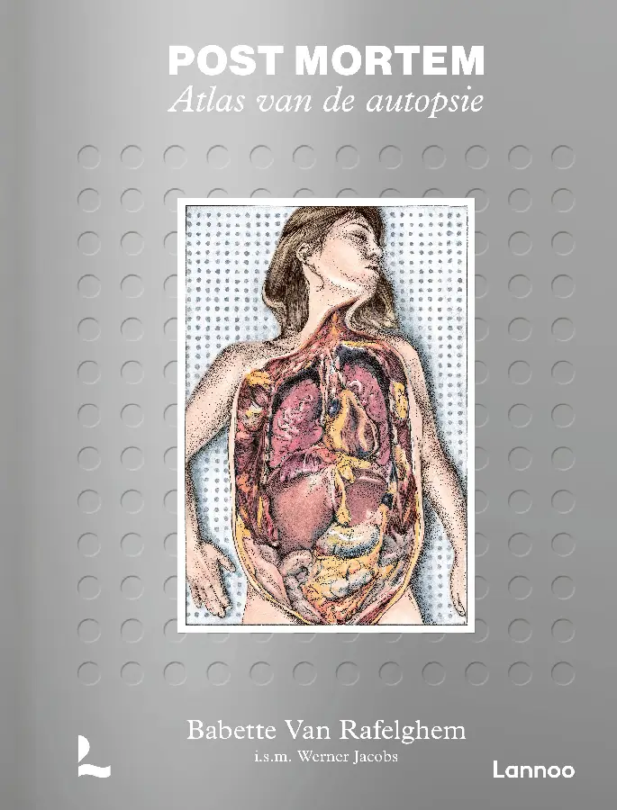 Post mortem. Atlas van de autopsie